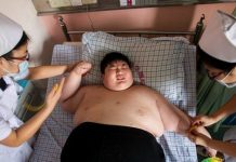 Afraid of death, a 14-year-old boy weighing 180kg cried and begged the doctor to help him lose weight, the end at the age of 21 made everyone sigh